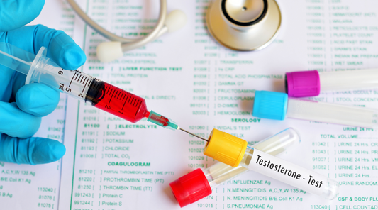 Testosterone test