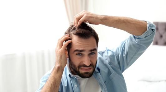 Young Man with Hair Loss Problem 