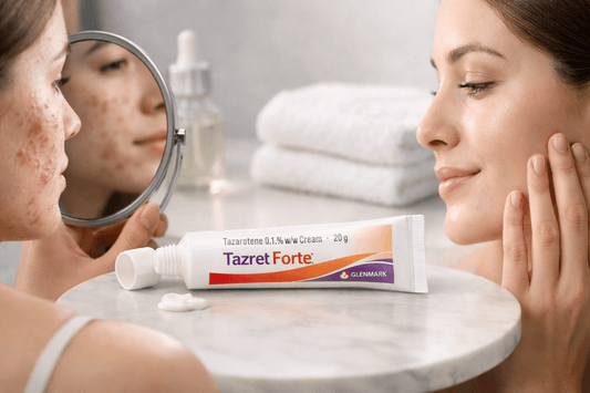 Tazret Forte Cream showing before and after acne results