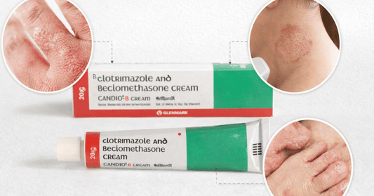 Candid B Cream is used for fungal skin infections like ringworm and athlete’s foot
