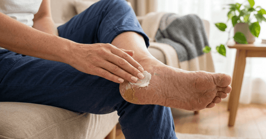Person applying foot cream for dry cracked heels at home
