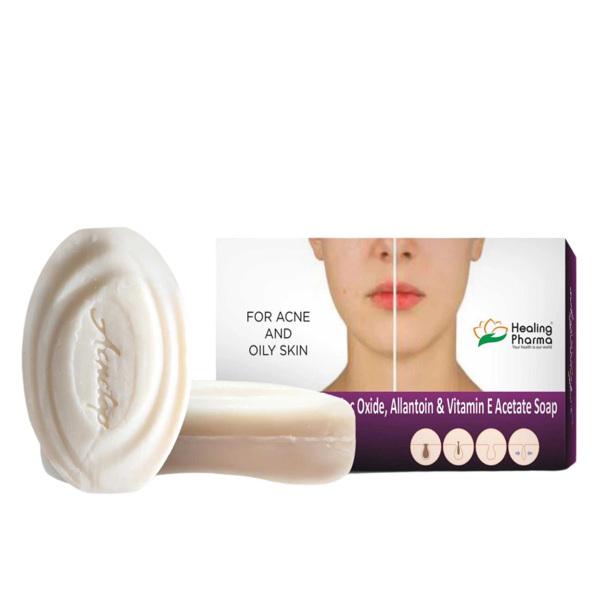 Acnetop Soap – ZaraMeds